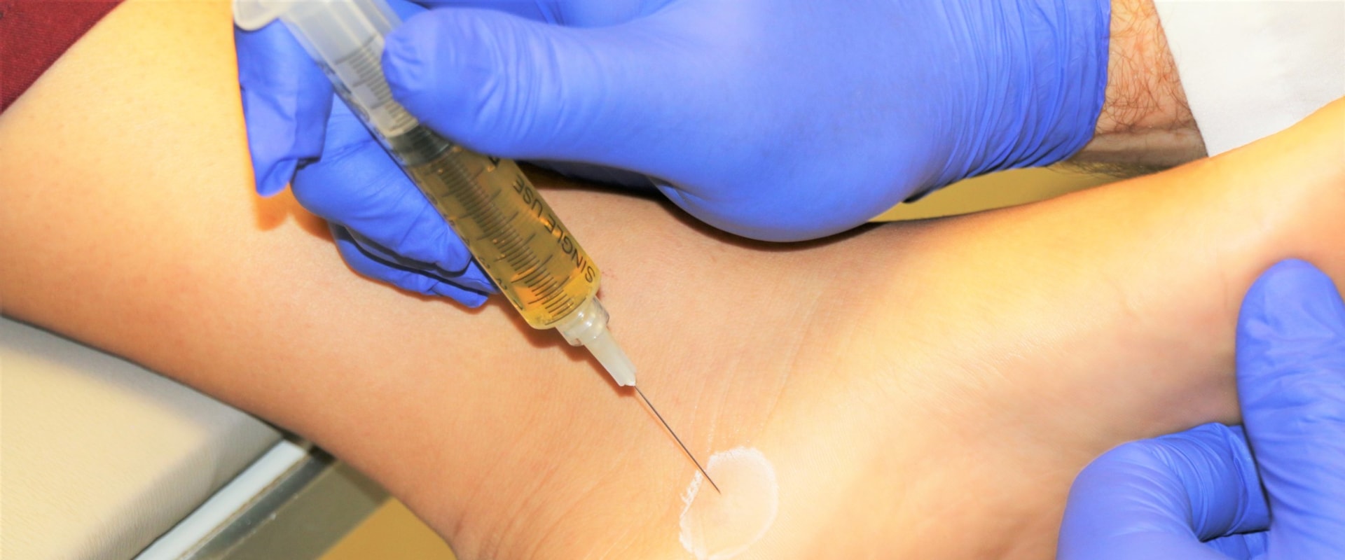 What Does a PRP Injection Feel Like?