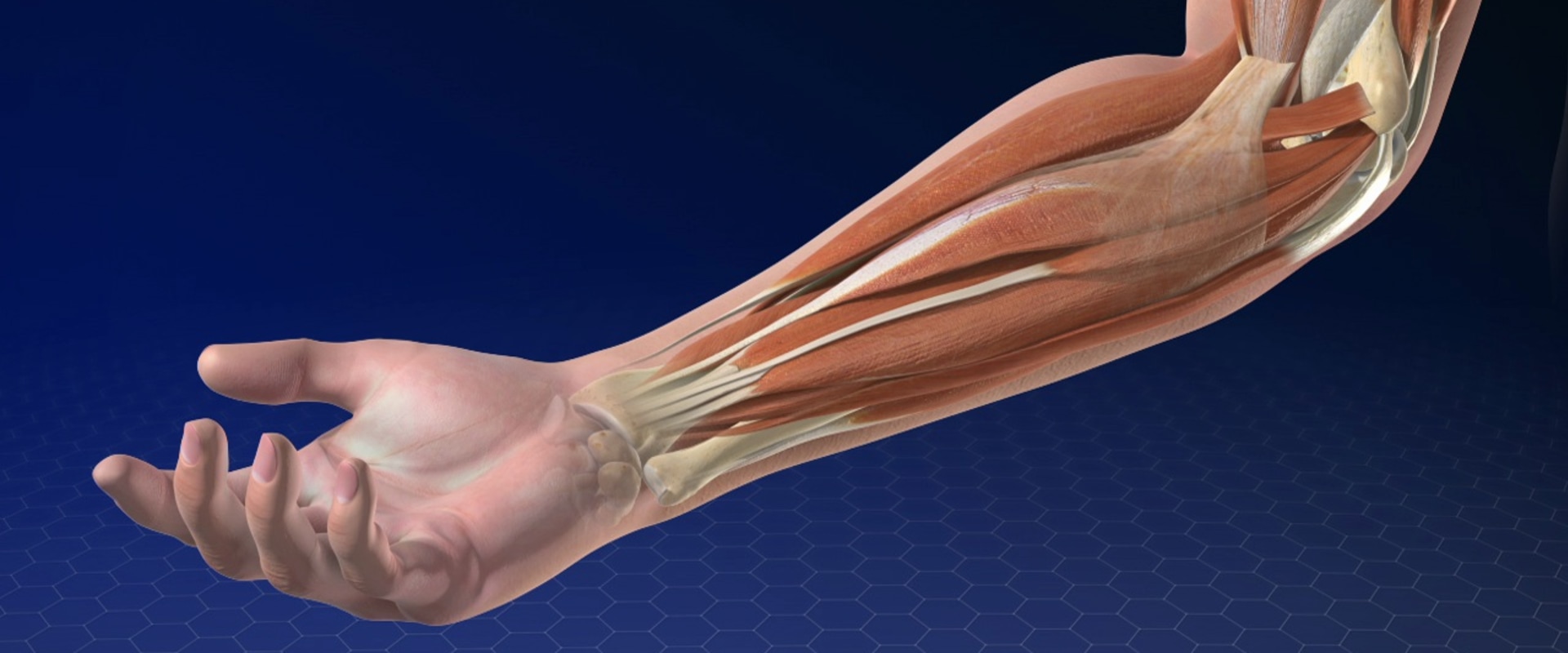 The Power of PRP for Golfer's Elbow: An Expert's Perspective