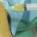 What to Expect After a PRP Injection