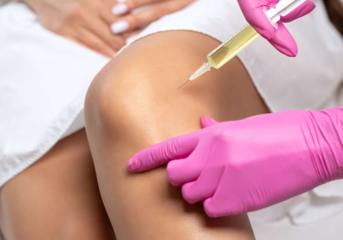 The Benefits of PRP Injections: A Comprehensive Guide