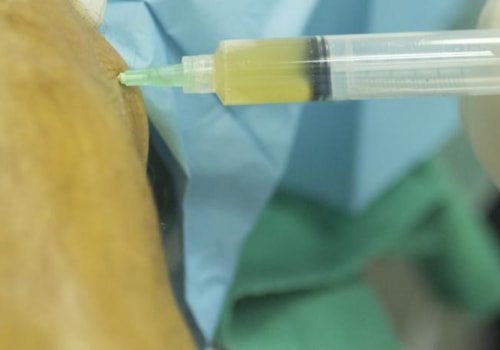 Are PRP Injections Painful? An Expert's Perspective