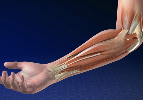 The Power of PRP for Golfer's Elbow: An Expert's Perspective